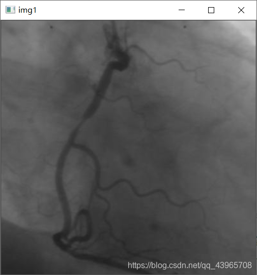 Python opencv醫學處理的實現過程