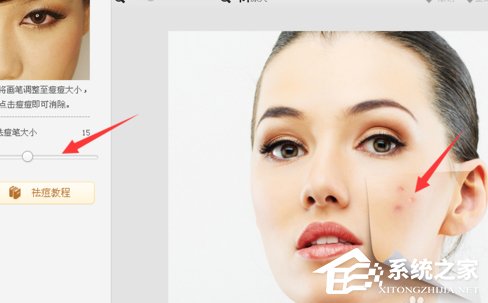 美圖秀秀怎么去除痘痘？美圖秀秀去除痘痘的方法