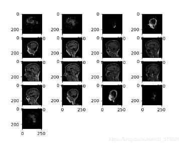 python 讀取.nii格式圖像實例