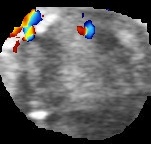 python opencv實(shí)現(xiàn)目標(biāo)區(qū)域裁剪功能
