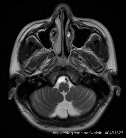 使用Python對Dicom文件進行讀取與寫入的實現