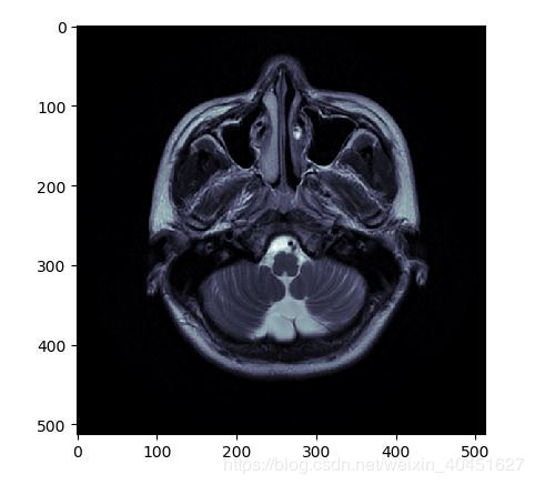 使用Python對Dicom文件進行讀取與寫入的實現