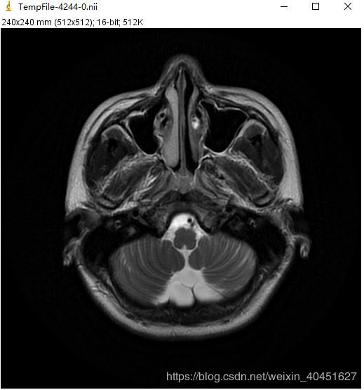 使用Python對Dicom文件進行讀取與寫入的實現